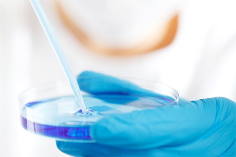 Alzheimer: Ursachen statt Symptome bek&auml;mpfen